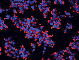 Diabète de type 2 : découverte d’un nouveau marqueur biologi ... Image 1