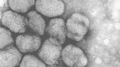 Alaskapox : ce que l'on sait sur le premier cas mortel dû à  ... Image 1
