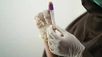 Un test sanguin, mis au point à Montpellier, bientôt disponi ... Image 1