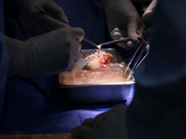 Des chirurgiens américains ont transplanté un rein de porc s ... Image 1
