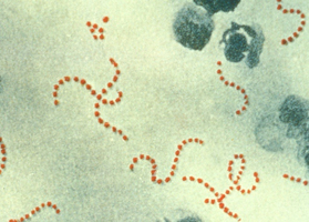 Streptocoque A : la hausse des infections à la bactérie mang ... Image 1