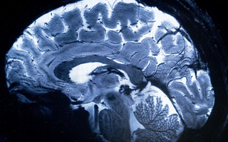 Sciences : des chercheurs français ont inventé l'IRM le plus ... Image 1