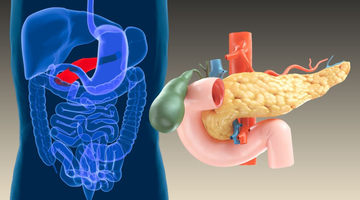 Cancer du pancréas : pourquoi cette maladie fait-elle si peu ... Image 1