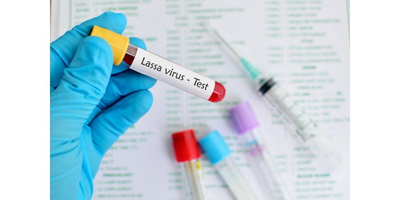 Fièvre de Lassa : faut-il craindre une épidémie en France. Image 1