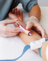 Bientôt une simple prise de sang pour détecter un cancer du  ... Image 1