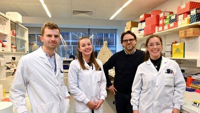 Cancer du pancréas : des chercheurs découvrent le point faib ... Image 1