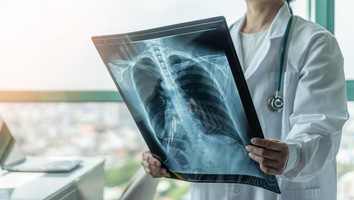 Cancer : la France mauvaise élève de la prévention. Image 1