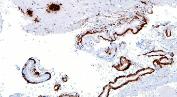 Une molécule de type « pseudo-prion » inverse les effets de  ... Image 1