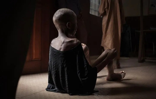 Afrique : L’inefficacité des antibiotiques chez les enfants  ... Image 1