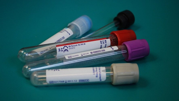 Hépatite B, chlamydia... Le dépistage de plusieurs IST gratu ... Image 1