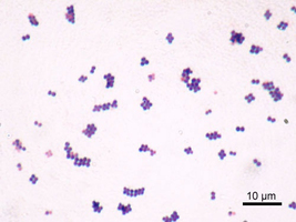 Staphylocoque doré : on a trouvé la faille de cette bactérie ... Image 1
