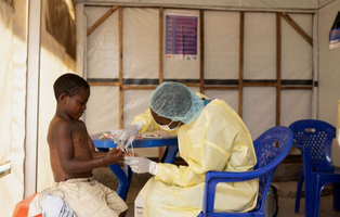 Une souche mortelle du virus de la Mpox se propage au-delà d ... Image 1