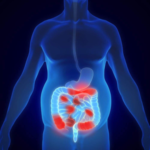 Voici comment les maladies inflammatoires chroniques de l'in ... Image 1