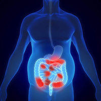 Voici comment les maladies inflammatoires chroniques de l'in ... Image 1