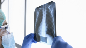 Une IA prodigieuse détecte désormais les maladies pulmonaire ... Image 1