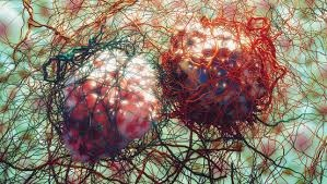 Cancer du poumon : un programme pilote révolutionnaire testé ... Image 1