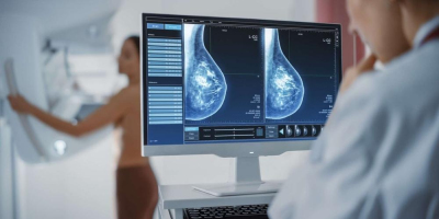 Cancer du sein : une hausse de 68 % des décès d’ici 2050. Image 1