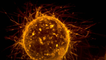 Cancer : et si le fer était la faille des cellules métastati ... Image 1
