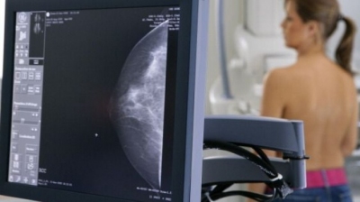 Cancers : les dépistages ont repris Image 1